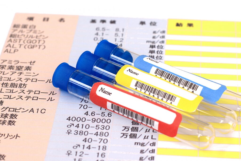 中性脂肪とコレステロール